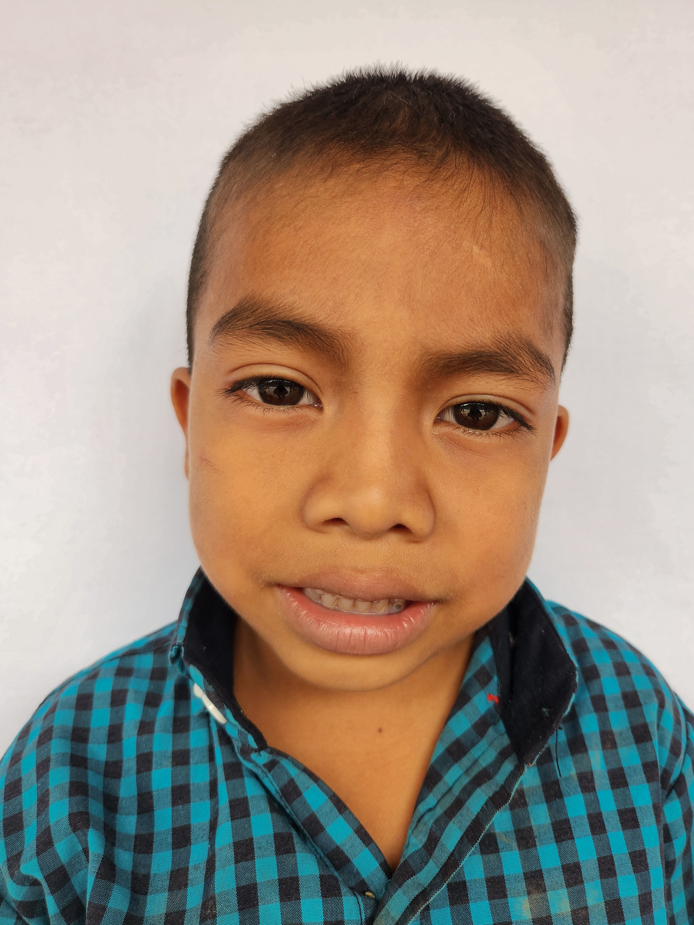 Photo of Melvin